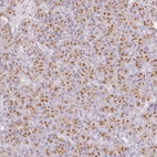 Immunohistochemical staining of human pancreas shows strong granular cytoplasmic positivity in exocrine glandular cells.