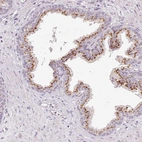Immunohistochemical staining of human prostate shows strong cytoplasm granular positivity in glandular cells.