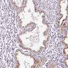 Immunohistochemical staining of human endometrium shows strong cytoplasm granular positivity in glandular cells.