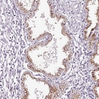 Immunohistochemical staining of human endometrium shows strong cytoplasm granular positivity in glandular cells.