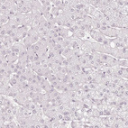 Immunohistochemical staining of human liver shows no positivity as expected.