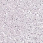 Immunohistochemical staining of human liver shows no positivity as expected.