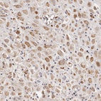 Anti-SCUBE2 Antibody