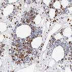 Immunohistochemical staining of human bone marrow shows moderate to strong granular cytoplasmic positivity in hematopoietic cells.