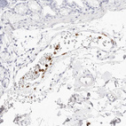 Immunohistochemical staining of human duodenum shows moderate to strong granular cytoplasmic positivity in leukocytes.