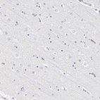 Immunohistochemical staining of human cerebral cortex shows no cytoplasmic positivity in neuronal cells as expected.
