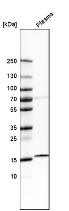 Western blot analysis in human plasma.