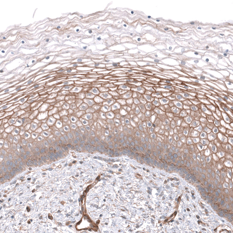 Anti-NKAIN4 Antibody
