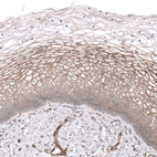 Anti-NKAIN4 Antibody