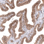 Immunohistochemical staining of human fallopian tube shows strong membranous positivity in glandular cells.