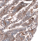 Immunohistochemical staining of human duodenum shows strong membranous positivity in glandular cells.