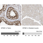 Anti-KPNB1 Antibody