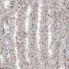 Anti-KPNB1 Antibody