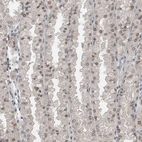Immunohistochemical staining of human stomach shows moderate nuclear and nuclear membrane positivity in glandular cells.