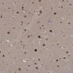 Immunohistochemical staining of human cerebral cortex shows moderate to strong nuclear and nuclear membrane positivity in neurons.