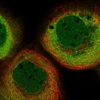 Immunofluorescent staining of human cell line A-431 shows localization to nucleoplasm, nuclear membrane & cytosol.