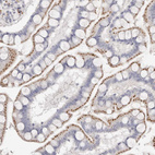 Anti-FAM185A Antibody
