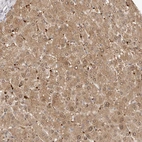 Immunohistochemical staining of human liver shows moderate granular cytoplasmic and nuclear positivity in hepatocytes.