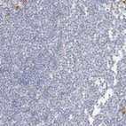 Immunohistochemical staining of human lymph node shows no positivity in germinal center cells as expected.