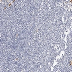 Immunohistochemical staining of human lymph node shows no positivity in germinal center cells as expected.
