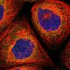 Immunofluorescent staining of human cell line A-431 shows localization to cytosol.