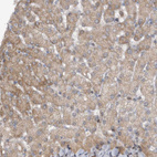 Anti-PGBD2 Antibody