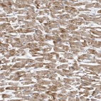 Immunohistochemical staining of human heart muscle shows moderate cytoplasmic positivity in cardiomyocytes.