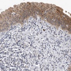 Anti-PGBD2 Antibody