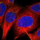 Immunofluorescent staining of human cell line A-431 shows localization to vesicles.
