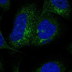 Immunofluorescent staining of human cell line U-2 OS shows localization to the Golgi apparatus & vesicles.
