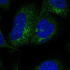 Anti-SLC26A11 Antibody