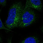 Immunofluorescent staining of human cell line U-2 OS shows localization to the Golgi apparatus & vesicles.