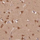 Anti-ERI3 Antibody