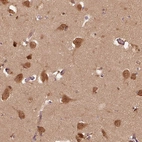 Anti-ERI3 Antibody