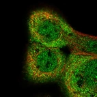 Immunofluorescent staining of human cell line A-431 shows localization to nucleoplasm & cytosol.