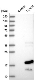 Anti-TSACC Antibody