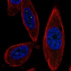 Immunofluorescent staining of human cell line PC-3 shows localization to nuclear bodies.