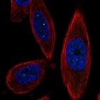 Immunofluorescent staining of human cell line PC-3 shows localization to nuclear bodies.