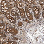 Immunohistochemical staining of human gastrointestinal shows strong cytoplasmic positivity in glandular cells.