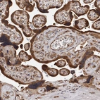 Immunohistochemical staining of human placenta shows strong cytoplasmic positivity in trophoblastic cells.