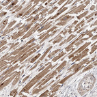 Immunohistochemical staining of human heart muscle shows strong cytoplasmic positivity in cardiomyocytes.