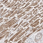 Immunohistochemical staining of human heart muscle shows strong cytoplasmic positivity in cardiomyocytes.