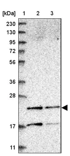 Lane 1: Marker [kDa] 230, 130, 95, 72, 56, 36, 28, 17, 11_br/_Lane 2: Human cell line RT-4_br/_Lane 3: Human cell line U-251MG sp