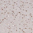 Anti-SOX4 Antibody