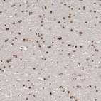 Anti-SOX4 Antibody