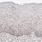 Immunohistochemical staining of human uterine cervix shows moderate nuclear positivity in a subset of epidermal cells.