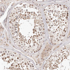 Anti-SOX4 Antibody