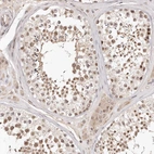 Immunohistochemical staining of human testis shows moderate nuclear positivity in cells in seminiferous ducts.