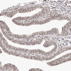 Immunohistochemical staining of human fallopian tube shows weak nuclear positivity in glandular cells.
