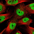 Immunofluorescent staining of human cell line U-251 MG shows localization to nucleoplasm.